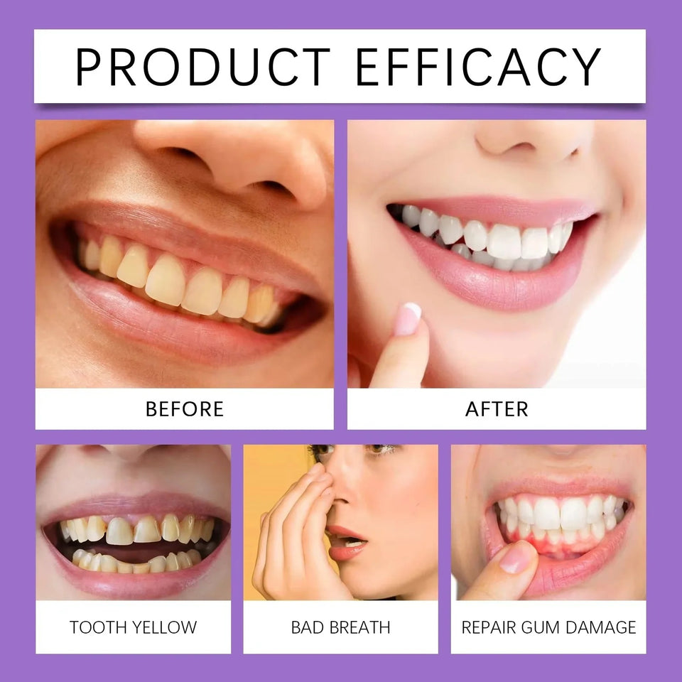 Teeth Whitening Strips