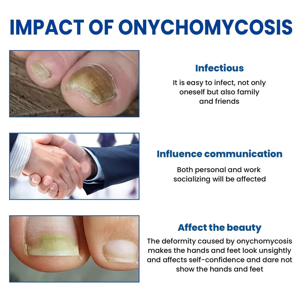 Fungal Nail Patches